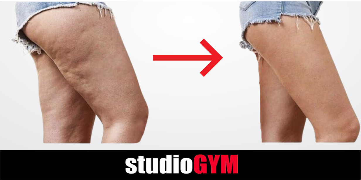 StudioGYM Vacu Activ Bieżnia | Szczecin Police | Fit Studio Figura Smukła Sylwetka | Fitness klub Vacu Bieżnia Podciśnienie Podczerwień | Siłownia Solarium Sauna Odchudzanie Opalanie Spa Welles